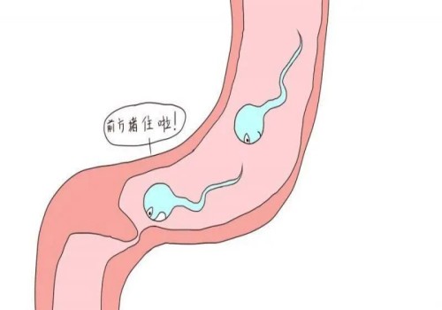 子宫肌瘤会自愈吗？为什么会患有子宫肌瘤？